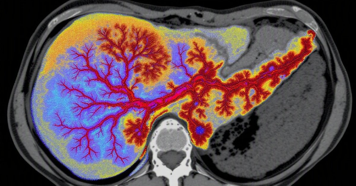 Veterinarian reviewing 3D CT scan images of a dog's liver on a computer screen in a clinic